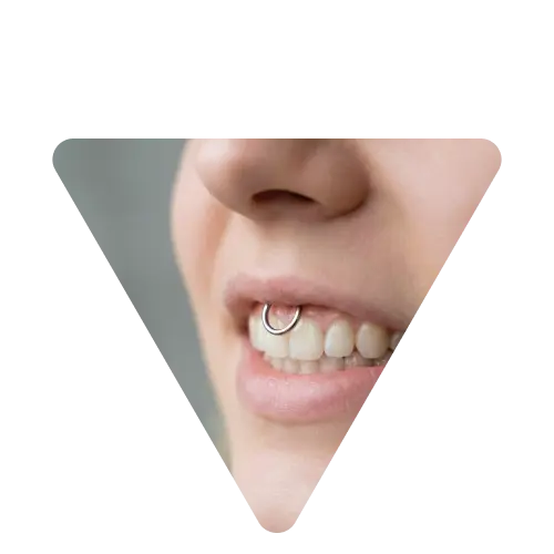 دختری با پیرسینگ اسمایل حلقه ای